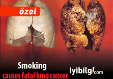 Sigarayı bırakmayı düşünmeyin: Sigarayı bırakın! -VİDEO