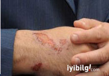 Saakaşvili savaşta yaralandı!