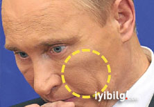 Putin’in yüzünde morluk!